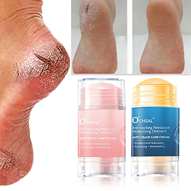 Ocheal Body Skin Foot Care Cream Repair Heel Hand Leg Anti-drying Anti-wrinkle Moisturizing Cracked Exfoliating Soft Care Cream