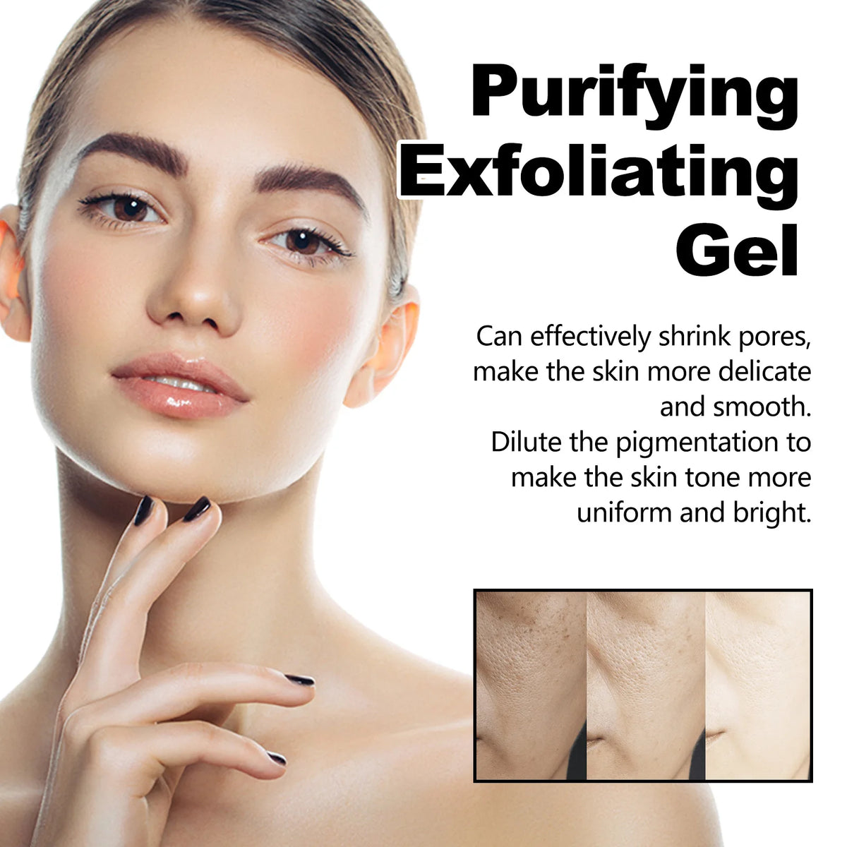 West&Month Exfoliating Peeling Gel - 50g Acne & Blackhead Treatment