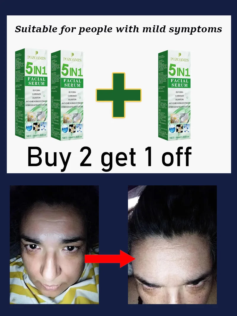 Secrets to a Youthful Appearance Qᵘⁱᶜᵏˡʸ Rᵉᵐᵒᵛᵉ Wʳⁱⁿᵏˡᵉˢ
