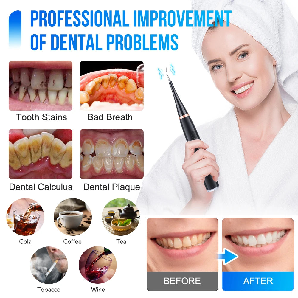 Dental Scaler Ultrasonic Scaler Tooth Cleaner Dental Stone Removal Electric Sonic Plaque Remover for Teeth Stain Tartar