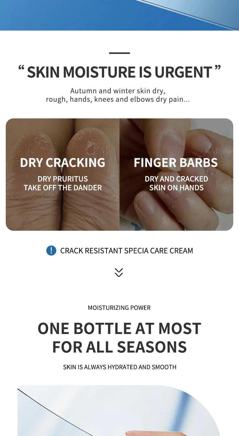 Ocheal Body Skin Foot Care Cream Repair Heel Hand Leg Anti-drying Anti-wrinkle Moisturizing Cracked Exfoliating Soft Care Cream