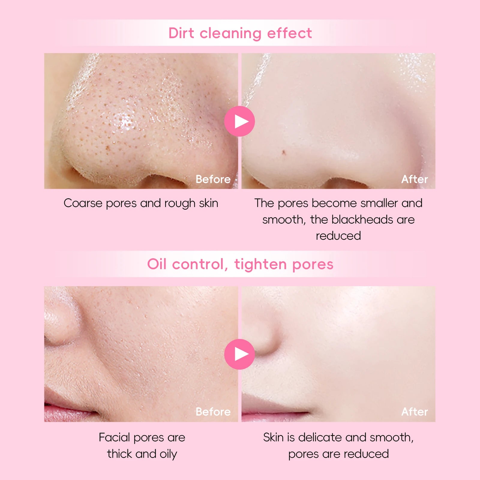 LAIKOU Japanese Sakura Skin Care Set - Hydrating Nourishing Moisturizing Soften Rough Skin for Radiant Complexion