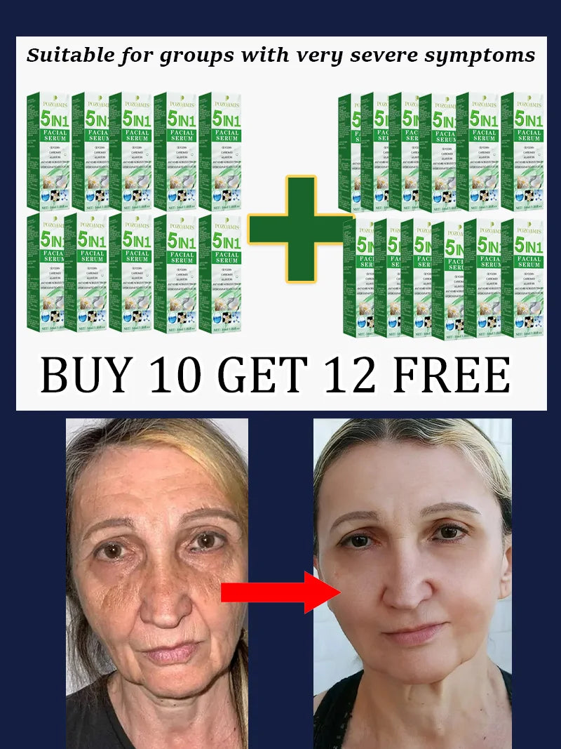 Secrets to a Youthful Appearance Qᵘⁱᶜᵏˡʸ Rᵉᵐᵒᵛᵉ Wʳⁱⁿᵏˡᵉˢ