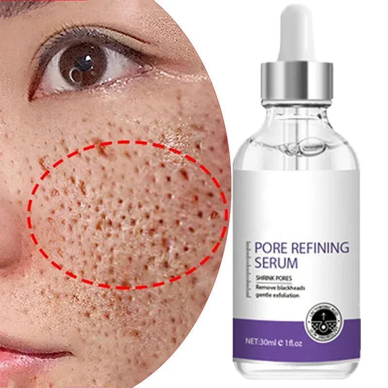 Skin Texture | Pore Refining Resurfacing, Brightening Facial Serum With Retinol And Niacinamide Non-Comedogenic