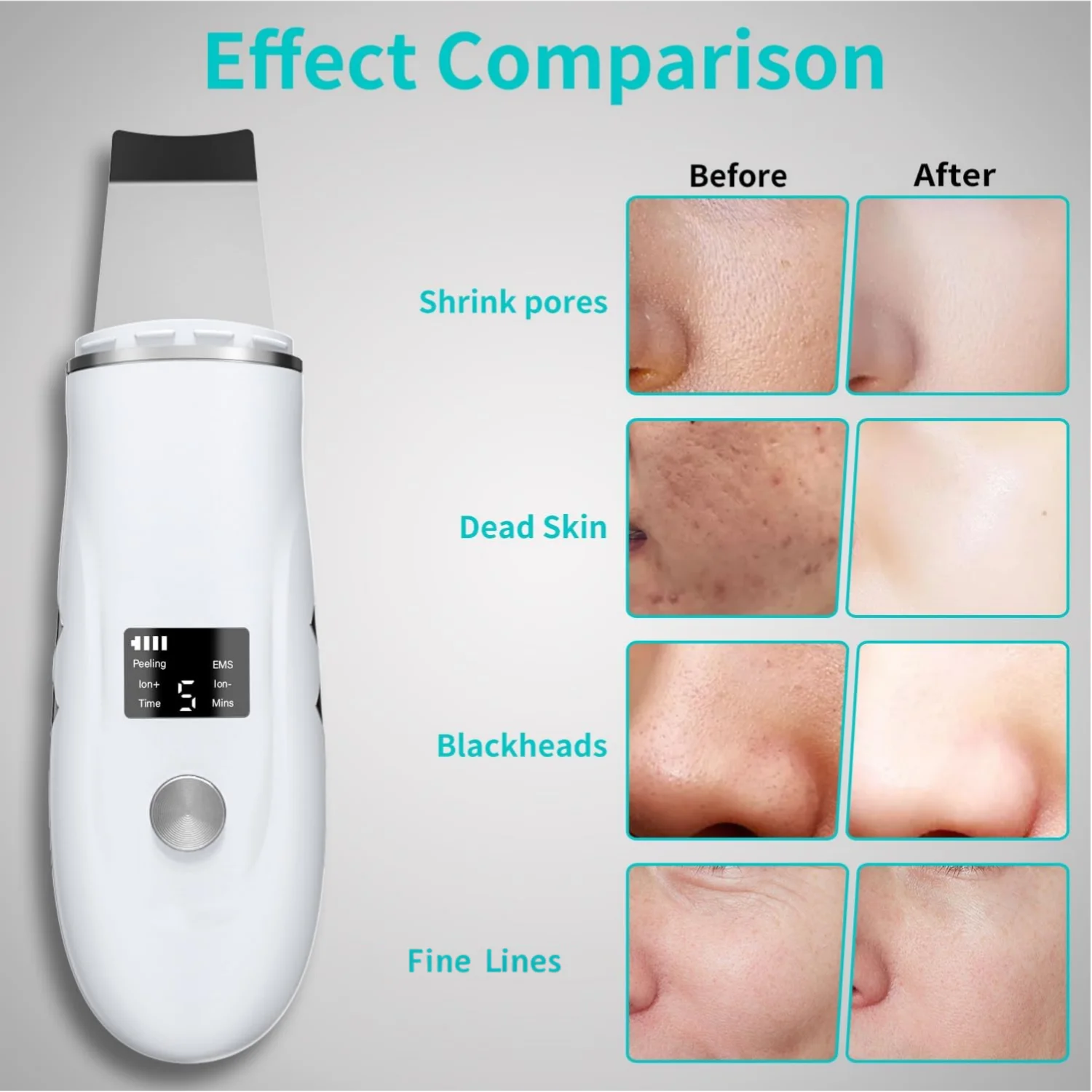 Ultrasonic Skin Scrubber Blackhead Remover Peeling Pore Cleaner Face Cleaning Blackhead Removal Shovel Face Deep Cleaning Device