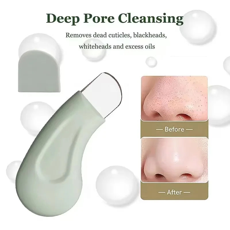 Blackhead And Whitehead Removal Tool For Nose And Face - Skin Pore Cleaner Skin Care Tools For Women'S