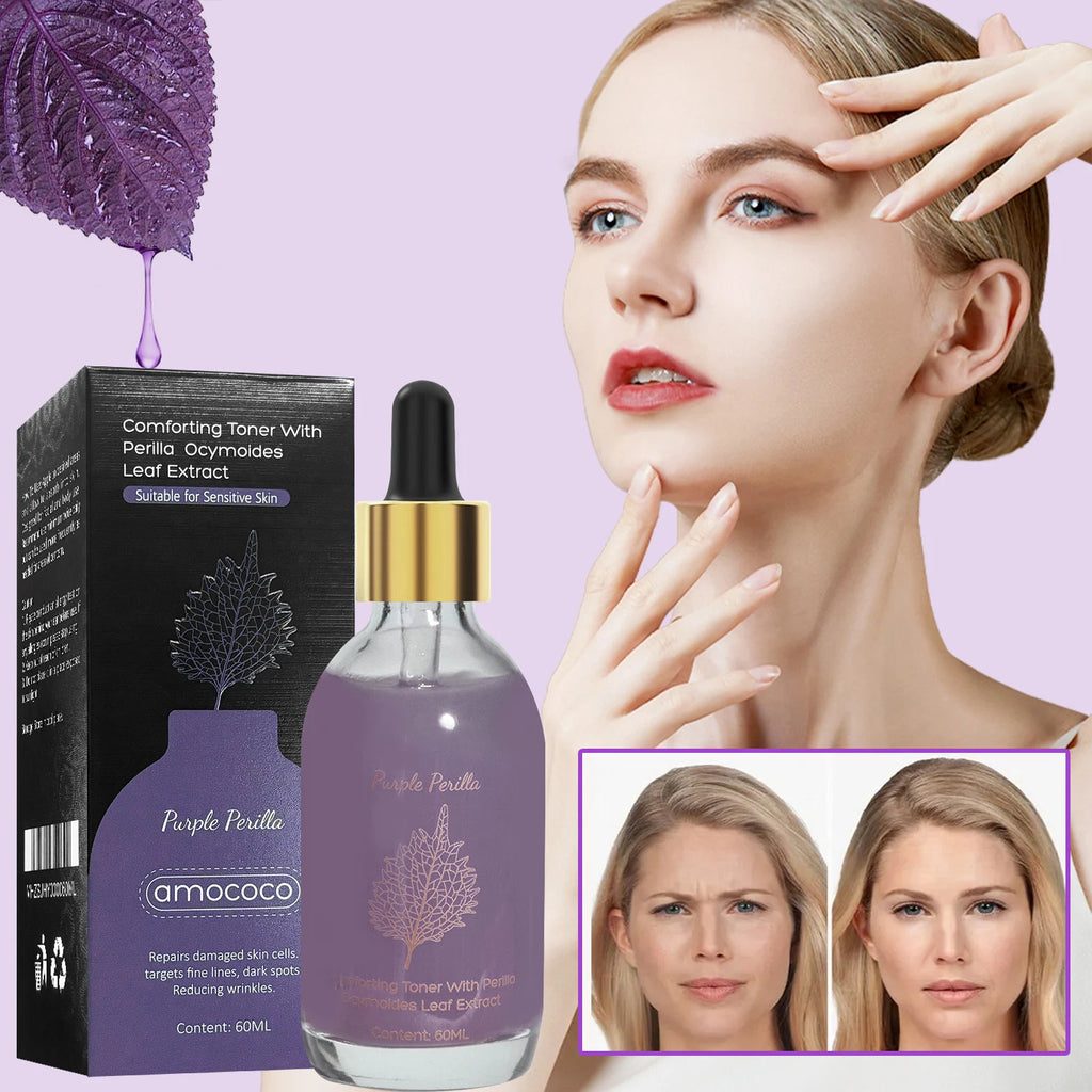 Amococo 2pcs Purple Perilla Calming Toner 60ml Each Soothing Essence for Sensitive Skin Helps Reduce Fine Lines Even Skin Tone K-Beauty