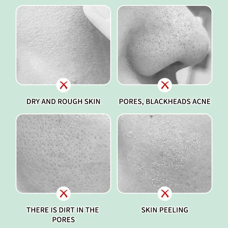 Herbal Exfoliating Gel Cream Moisturizer Face Body Scrub Gel Deep Cleansing Moisturizing Facial Exfoliator Peeling Face Scrub