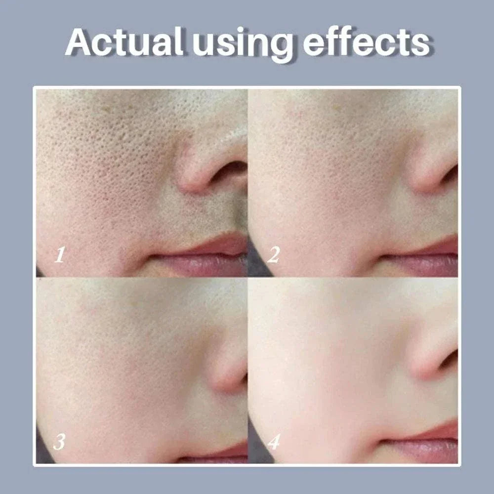 Skin Texture | Pore Refining Resurfacing, Brightening Facial Serum With Retinol And Niacinamide Non-Comedogenic