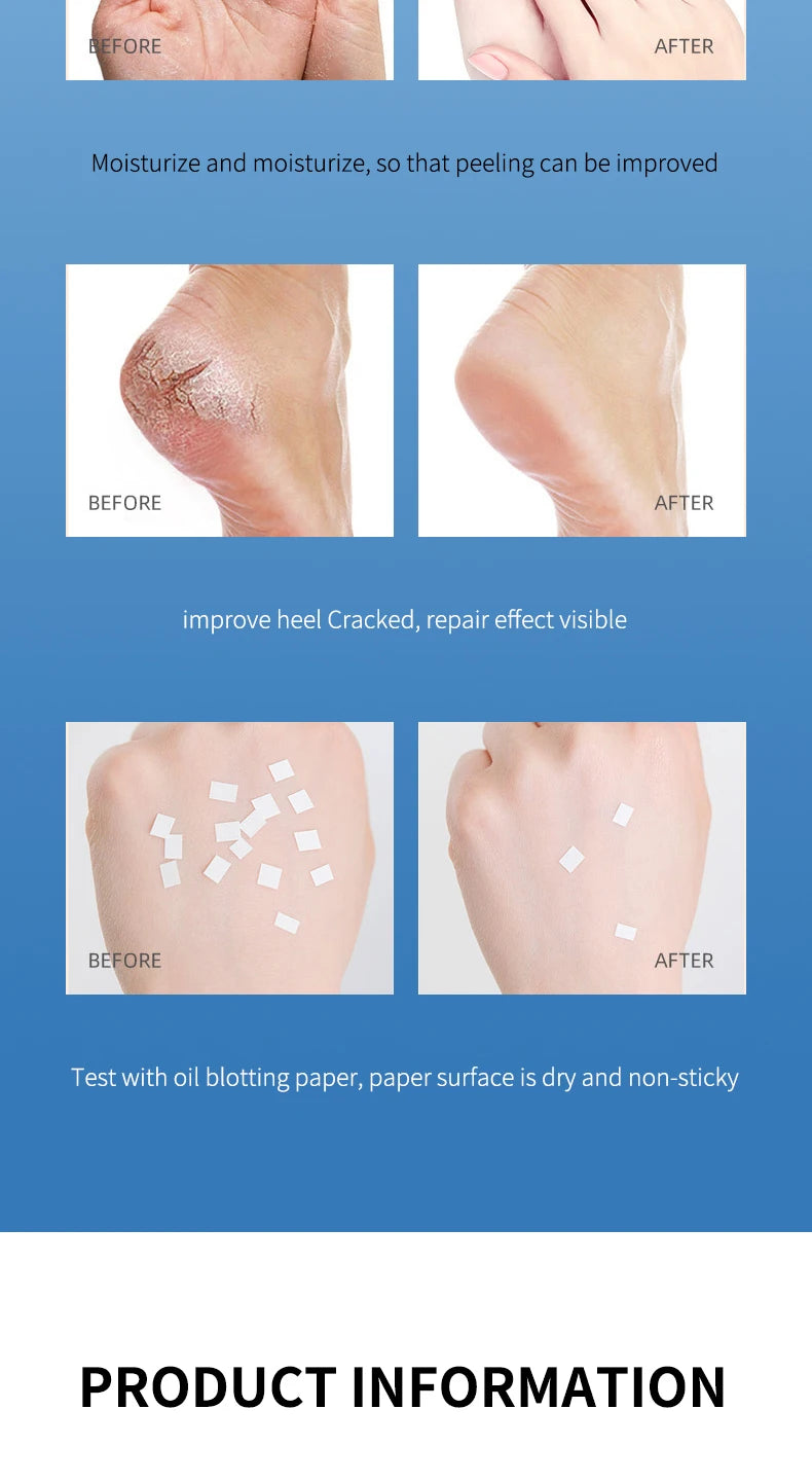 Ocheal Body Skin Foot Care Cream Repair Heel Hand Leg Anti-drying Anti-wrinkle Moisturizing Cracked Exfoliating Soft Care Cream